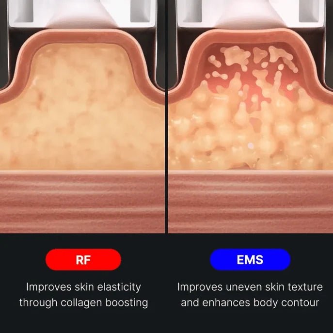 AGE-R Contour Body Shot - Medicube
