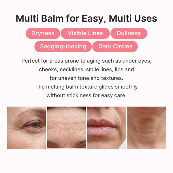 The Next Purchase, Included