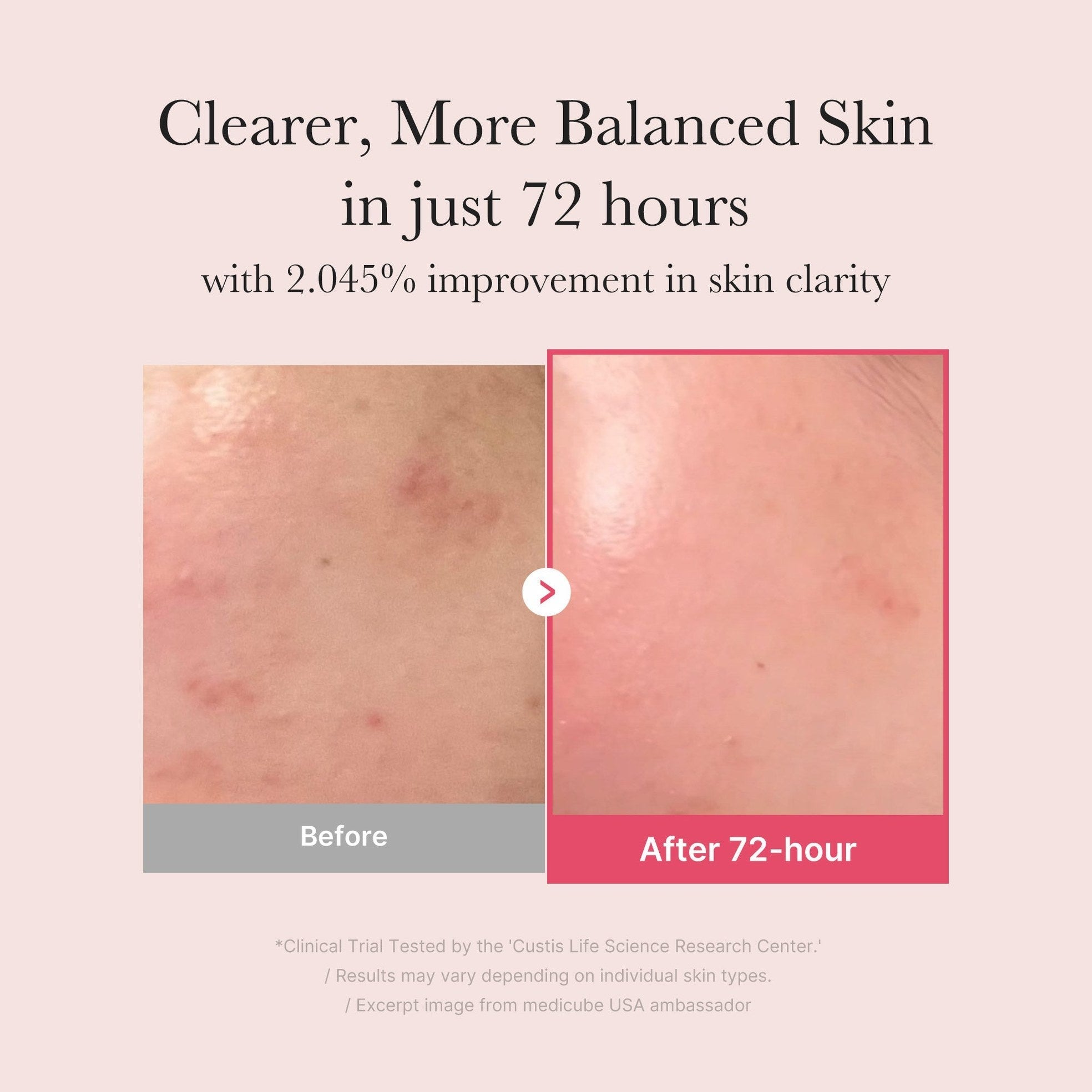 TXA Niacinamide Serum - Medicube