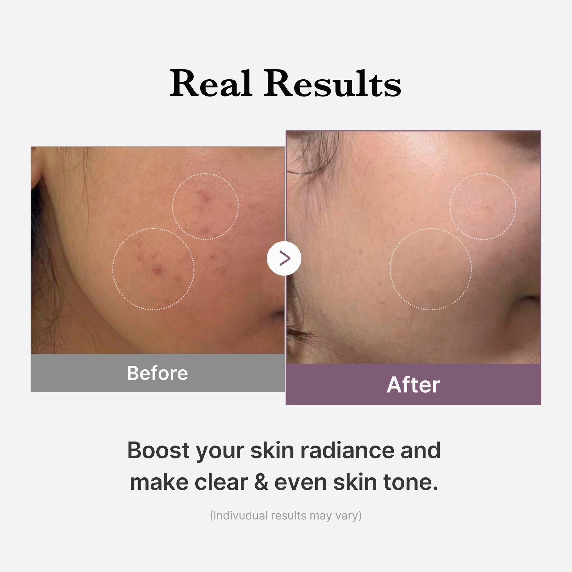 AGE-R Glutathione Glow Milk Toner - Medicube