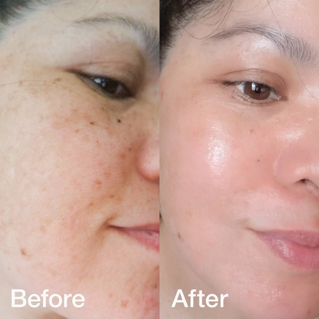 Collagen Booster Set - Medicube