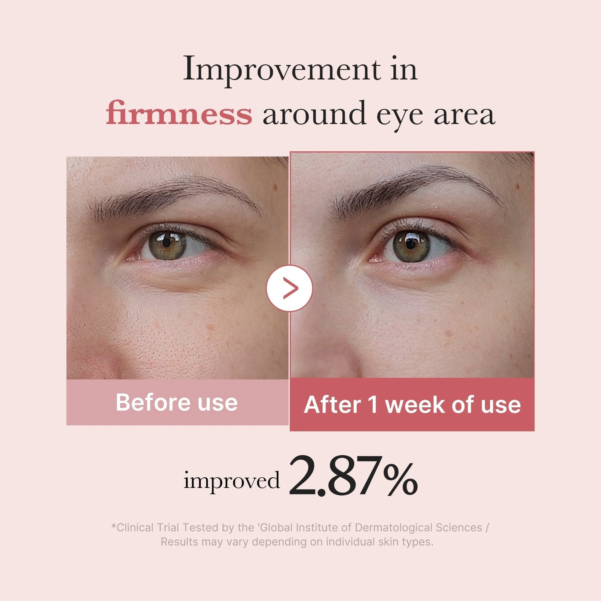 PDRN Pink Peptide Eye Cream - Medicube