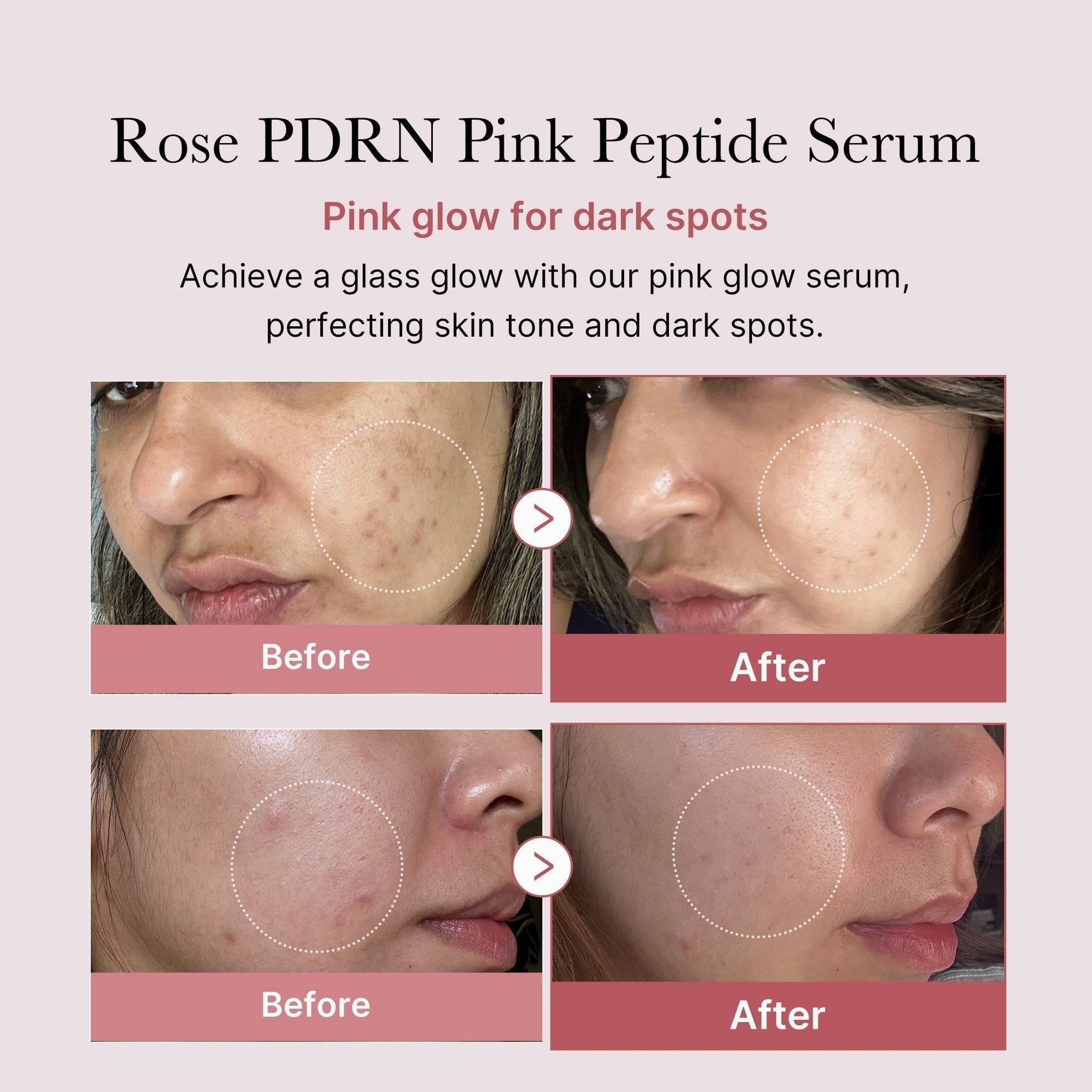 PDRN Pink Peptide Serum - Medicube